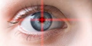 Cirurgia Refrativa